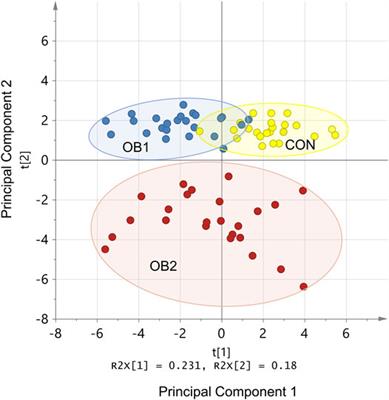 Characterization and Comparison of the Divergent Metabolic Consequences of High-Sugar and High-Fat Diets in Male Wistar Rats